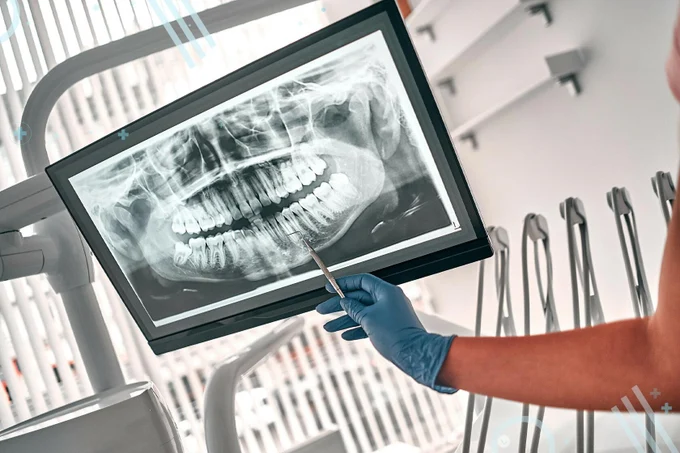 Рентгенодиагностика