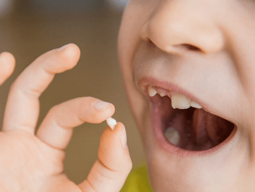 Удаление молочных Зубов