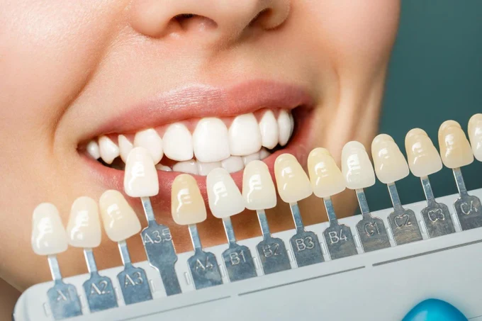 Эстетическая стоматология